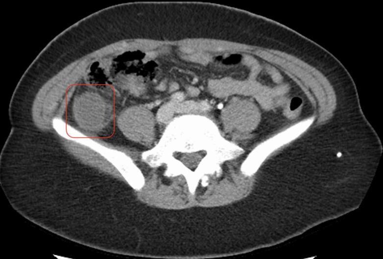 https://cdn.ncbi.nlm.nih.gov/pmc/blobs/a6cc/12060468/feee0922c11b/gr5.jpg