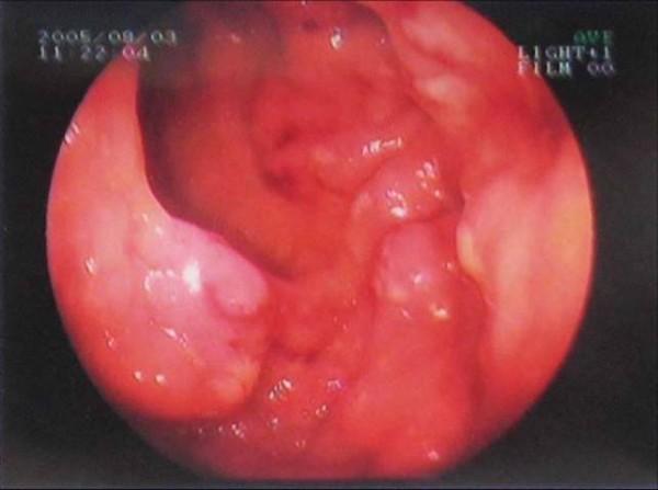 https://cdn.ncbi.nlm.nih.gov/pmc/blobs/a6cc/2803979/9fbdc9d055a6/1757-1626-2-9316-1.jpg