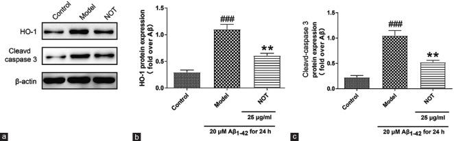 https://cdn.ncbi.nlm.nih.gov/pmc/blobs/a6cc/7282681/7e955d1bf5cc/IJPharm-52-94-g006.jpg