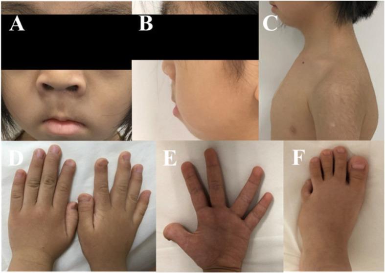 https://cdn.ncbi.nlm.nih.gov/pmc/blobs/a6cd/7060511/d1cf6c6152e9/12891_2020_3181_Fig1_HTML.jpg