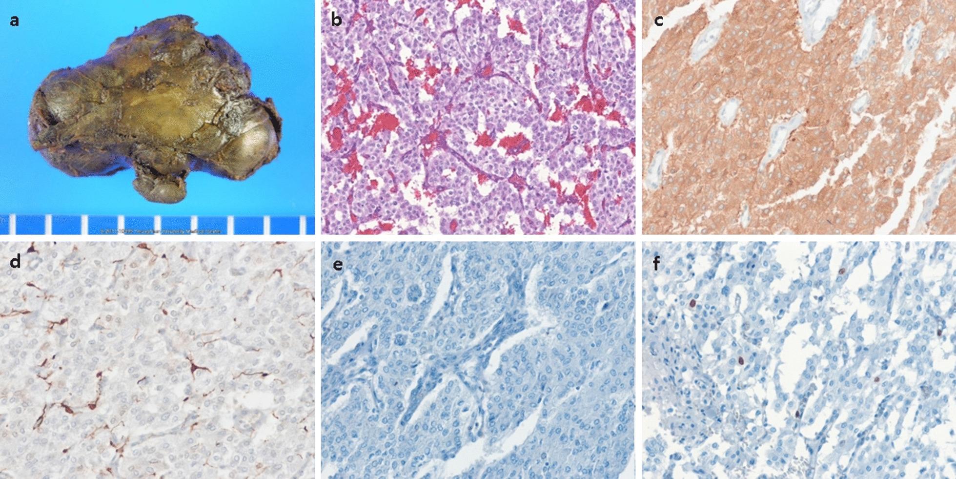 https://cdn.ncbi.nlm.nih.gov/pmc/blobs/a6ce/7682027/2fafabe4e0ca/12872_2020_1752_Fig2_HTML.jpg