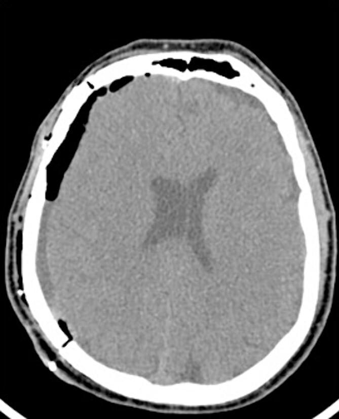 https://cdn.ncbi.nlm.nih.gov/pmc/blobs/a6d1/11132867/a1a4d43dbb65/rjae341f3.jpg