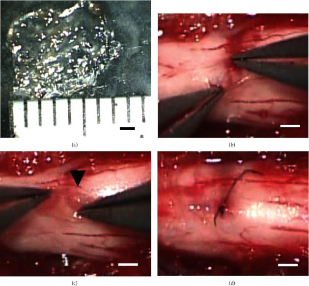 https://cdn.ncbi.nlm.nih.gov/pmc/blobs/a6d4/8285204/01d6b0c89c08/SCI2021-9964877.001.jpg