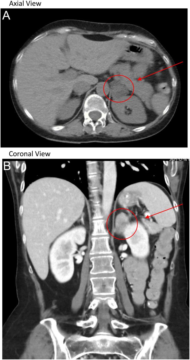 https://cdn.ncbi.nlm.nih.gov/pmc/blobs/a6d8/11301536/4dcf355a97dc/EDM23-0152fig1.jpg
