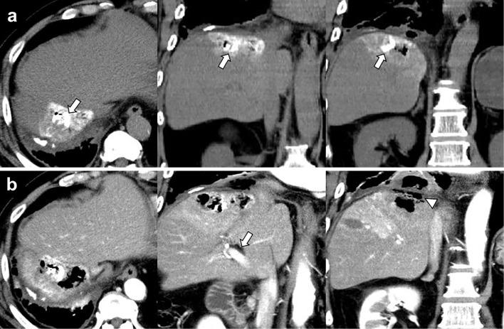 https://cdn.ncbi.nlm.nih.gov/pmc/blobs/a6da/10125827/a76ffd89fff5/1349-7235-62-0999-g003.jpg