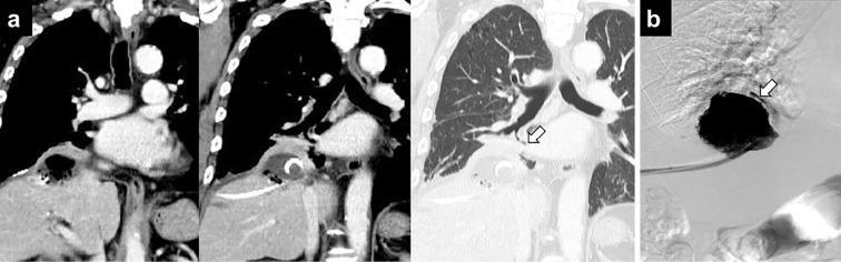 https://cdn.ncbi.nlm.nih.gov/pmc/blobs/a6da/10125827/c1e9f9483c19/1349-7235-62-0999-g004.jpg