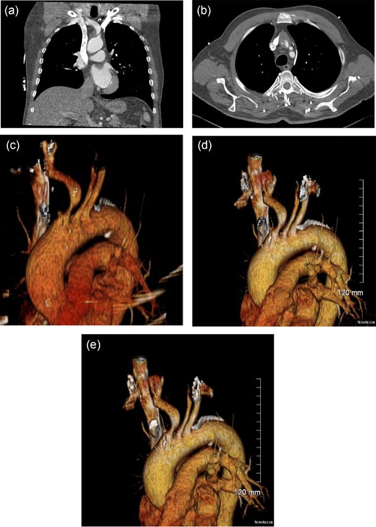 https://cdn.ncbi.nlm.nih.gov/pmc/blobs/a6dc/8965028/05bba61617bf/gr2.jpg
