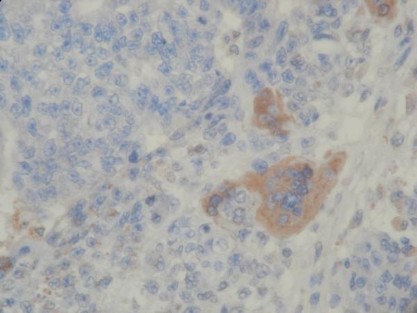 https://cdn.ncbi.nlm.nih.gov/pmc/blobs/a6de/2851696/a2aec79a60ea/1477-7819-8-21-4.jpg