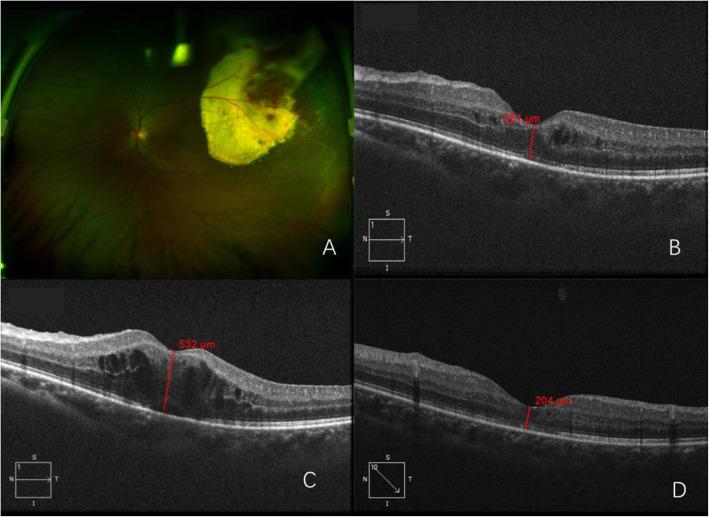 https://cdn.ncbi.nlm.nih.gov/pmc/blobs/a6e7/7329434/d369122cc783/12886_2020_1474_Fig2_HTML.jpg