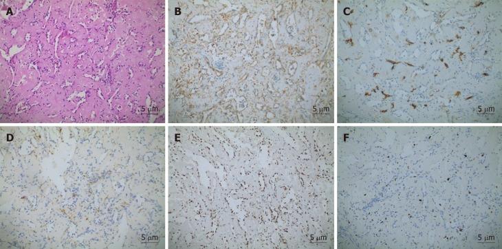 https://cdn.ncbi.nlm.nih.gov/pmc/blobs/a6e8/7103981/ef90a3e35e7a/WJCC-8-1108-g002.jpg