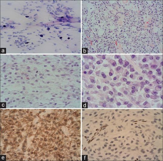 https://cdn.ncbi.nlm.nih.gov/pmc/blobs/a6ef/5843975/1cfcf15747d0/SNI-9-45-g002.jpg