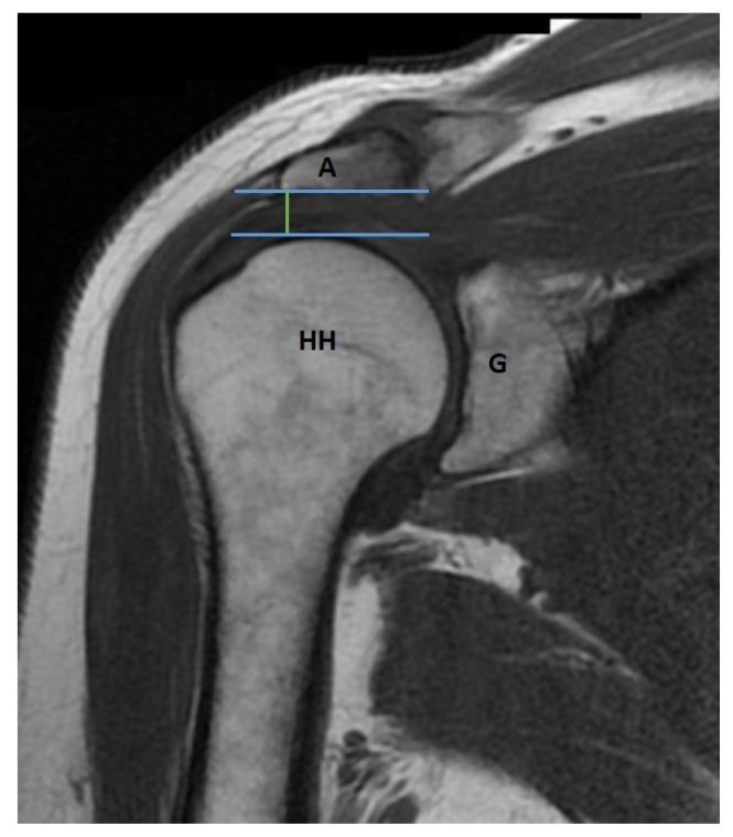 https://cdn.ncbi.nlm.nih.gov/pmc/blobs/a6f0/10387881/97bcc44c2659/turkjmedsci-53-1-273f5.jpg