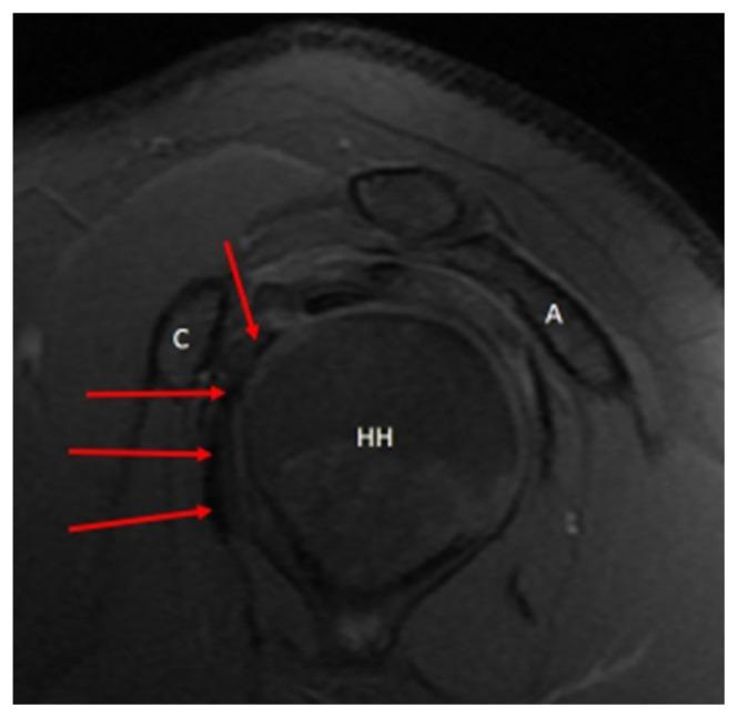 https://cdn.ncbi.nlm.nih.gov/pmc/blobs/a6f0/10387881/d8a1018bce19/turkjmedsci-53-1-273f4.jpg