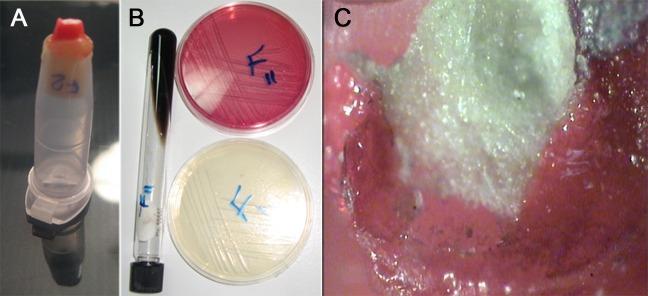 https://cdn.ncbi.nlm.nih.gov/pmc/blobs/a6f1/3471568/37e4dc23fdf5/iej-05-17-g001.jpg