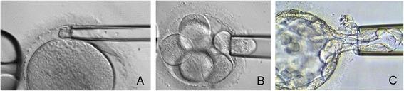 https://cdn.ncbi.nlm.nih.gov/pmc/blobs/a6f4/4300308/3689280b0b08/40064_2015_788_Fig1_HTML.jpg