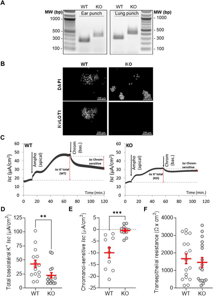 https://cdn.ncbi.nlm.nih.gov/pmc/blobs/a6f8/9868633/b40a02da7007/fphys-13-1069466-g001.jpg