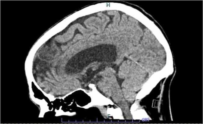 https://cdn.ncbi.nlm.nih.gov/pmc/blobs/a6fa/9293625/bf66fd7dc8cb/gr3.jpg
