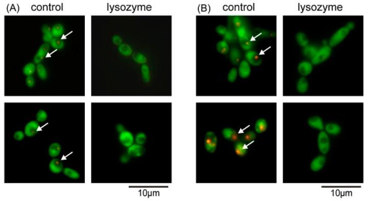 https://cdn.ncbi.nlm.nih.gov/pmc/blobs/a6fb/11274442/73ef1de74369/biomimetics-09-00425-g011.jpg