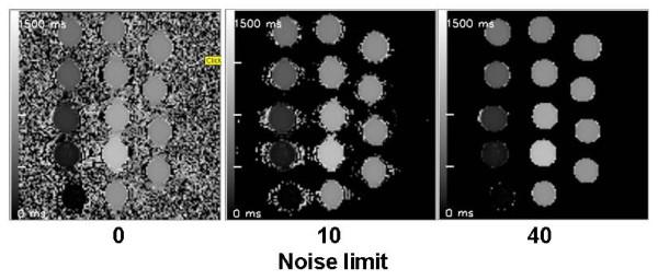 https://cdn.ncbi.nlm.nih.gov/pmc/blobs/a704/2919441/0d62918e4314/1471-2342-10-16-5.jpg