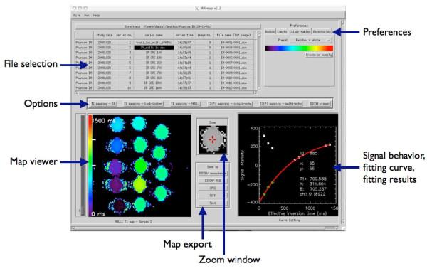 https://cdn.ncbi.nlm.nih.gov/pmc/blobs/a704/2919441/812a992da168/1471-2342-10-16-1.jpg