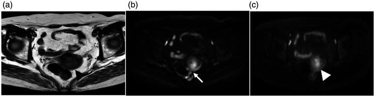 https://cdn.ncbi.nlm.nih.gov/pmc/blobs/a705/7903838/10db66b444a4/10.1177_2058460121994737-fig5.jpg