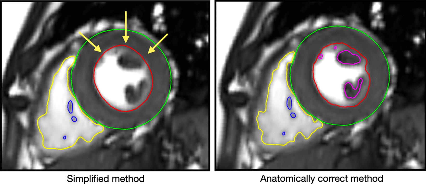 https://cdn.ncbi.nlm.nih.gov/pmc/blobs/a70d/8722350/1ffbdb0a3e5b/12968_2021_819_Fig3_HTML.jpg