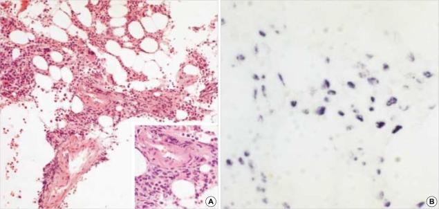 https://cdn.ncbi.nlm.nih.gov/pmc/blobs/a713/2822304/87f16ff6946a/jkms-19-229-g001.jpg