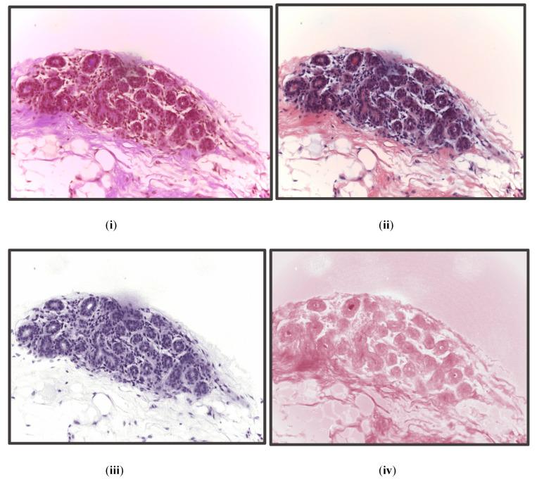 https://cdn.ncbi.nlm.nih.gov/pmc/blobs/a717/9818545/43d530275a30/diagnostics-13-00126-g004.jpg
