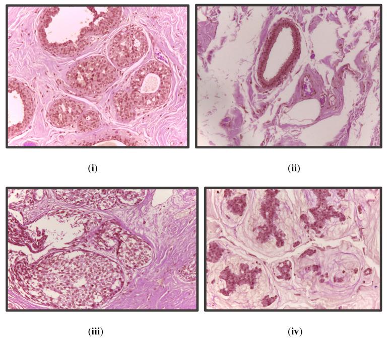 https://cdn.ncbi.nlm.nih.gov/pmc/blobs/a717/9818545/daaee0302e3f/diagnostics-13-00126-g002.jpg
