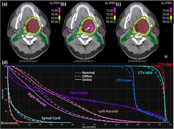 https://cdn.ncbi.nlm.nih.gov/pmc/blobs/a71b/11087169/e973bef277dd/ACM2-25-e14308-g002.jpg