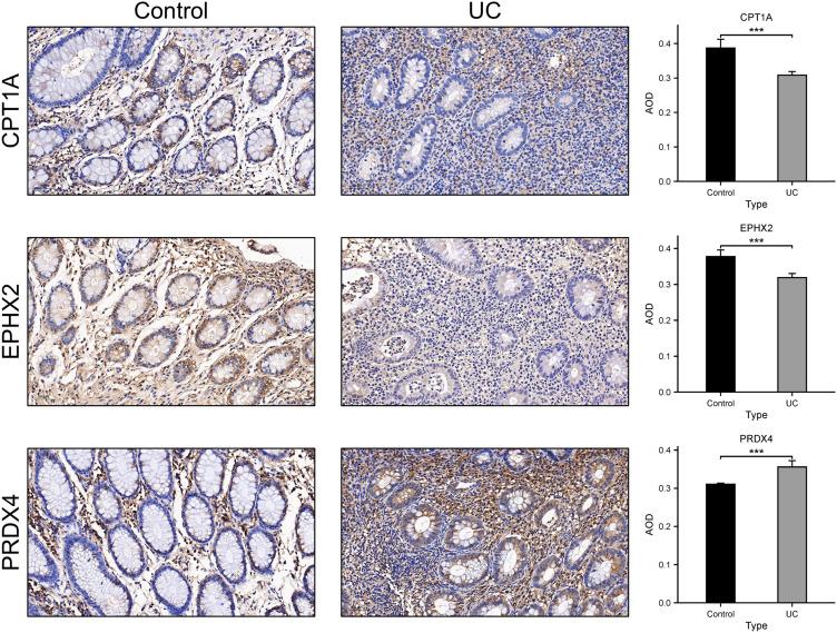 https://cdn.ncbi.nlm.nih.gov/pmc/blobs/a71e/12050211/98d11723cec9/JIR-18-5835-g0008.jpg