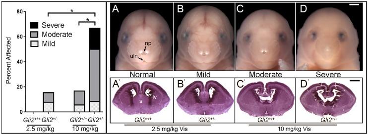 https://cdn.ncbi.nlm.nih.gov/pmc/blobs/a725/5117230/5d45e6afd14b/dmm-9-026328-g5.jpg