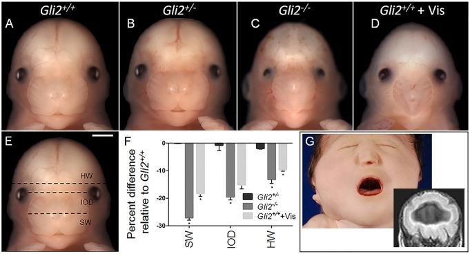 https://cdn.ncbi.nlm.nih.gov/pmc/blobs/a725/5117230/9a0f7cc66703/dmm-9-026328-g1.jpg