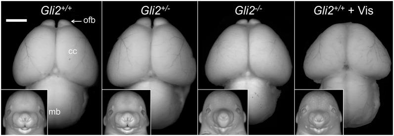 https://cdn.ncbi.nlm.nih.gov/pmc/blobs/a725/5117230/a9464470eb17/dmm-9-026328-g2.jpg