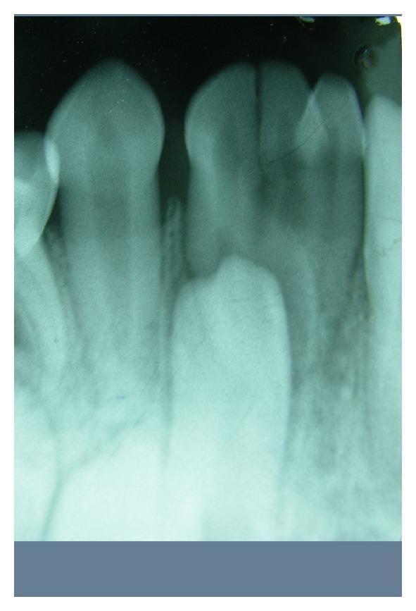 https://cdn.ncbi.nlm.nih.gov/pmc/blobs/a727/3533612/48ec48a1b900/CRIM.DENTISTRY2012-735925.003.jpg