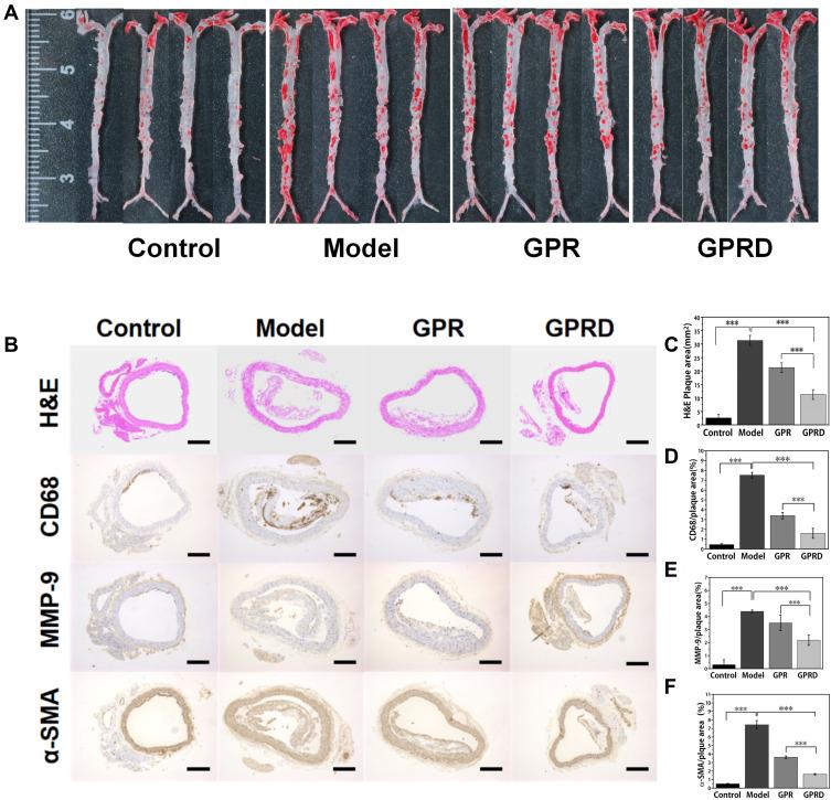 https://cdn.ncbi.nlm.nih.gov/pmc/blobs/a72b/9677925/cec29782777c/IJN-17-5413-g0007.jpg