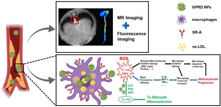 https://cdn.ncbi.nlm.nih.gov/pmc/blobs/a72b/9677925/f6c372c457f2/IJN-17-5413-g0001.jpg