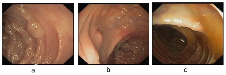 https://cdn.ncbi.nlm.nih.gov/pmc/blobs/a72c/9407378/0da2a877e97b/diagnostics-12-02030-g008.jpg