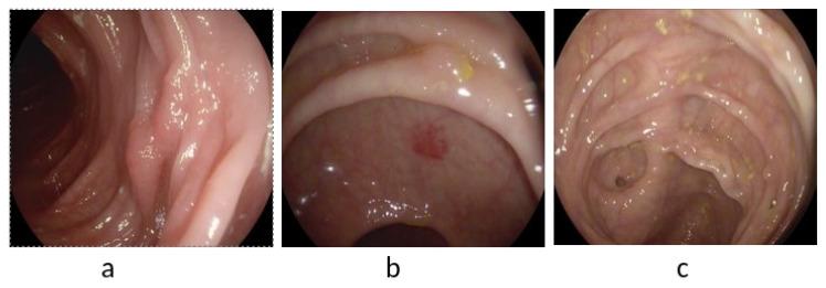 https://cdn.ncbi.nlm.nih.gov/pmc/blobs/a72c/9407378/32cdc42c6ae8/diagnostics-12-02030-g009.jpg