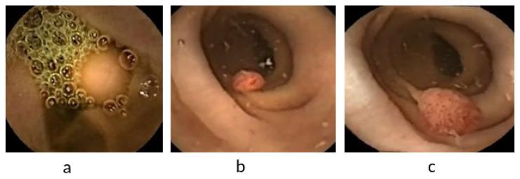 https://cdn.ncbi.nlm.nih.gov/pmc/blobs/a72c/9407378/48640982b4eb/diagnostics-12-02030-g007.jpg