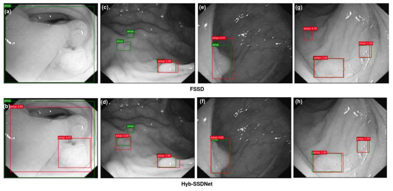 https://cdn.ncbi.nlm.nih.gov/pmc/blobs/a72c/9407378/76c2b11501e1/diagnostics-12-02030-g012.jpg