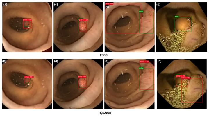 https://cdn.ncbi.nlm.nih.gov/pmc/blobs/a72c/9407378/f1502d7c4888/diagnostics-12-02030-g011.jpg
