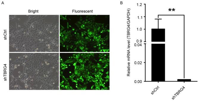 https://cdn.ncbi.nlm.nih.gov/pmc/blobs/a732/5769239/53189ac7ed42/ol-15-01-0121-g00.jpg