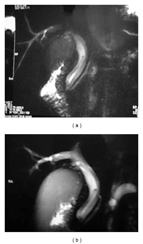 https://cdn.ncbi.nlm.nih.gov/pmc/blobs/a737/3437613/6499ff5f14c1/CRIM.SURGERY2012-561563.002.jpg