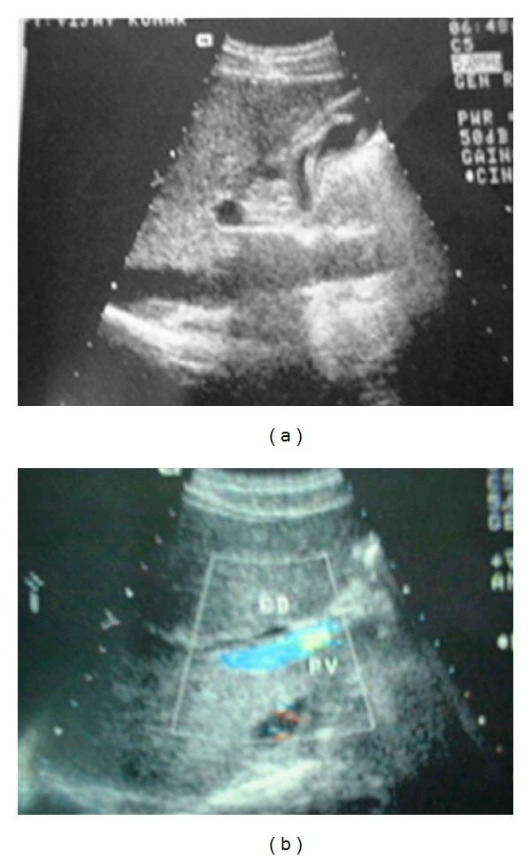 https://cdn.ncbi.nlm.nih.gov/pmc/blobs/a737/3437613/726f787dd8ec/CRIM.SURGERY2012-561563.001.jpg