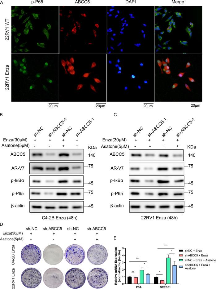 https://cdn.ncbi.nlm.nih.gov/pmc/blobs/a73b/9065095/a5270144a72b/41420_2022_951_Fig6_HTML.jpg