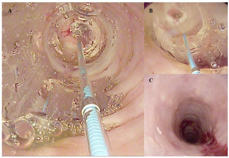 https://cdn.ncbi.nlm.nih.gov/pmc/blobs/a744/11049211/4d83f6e8796e/diagnostics-14-00858-g003.jpg