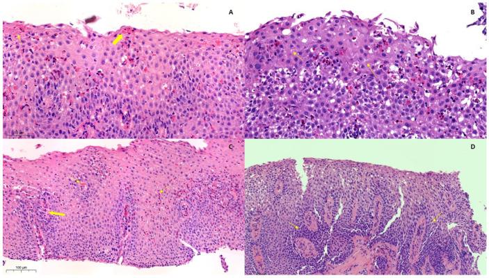 https://cdn.ncbi.nlm.nih.gov/pmc/blobs/a744/11049211/c6012de5e931/diagnostics-14-00858-g004.jpg