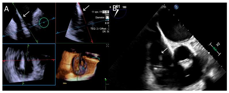 https://cdn.ncbi.nlm.nih.gov/pmc/blobs/a74c/12112266/7b98d11a8c61/jcdd-12-00165-g006.jpg
