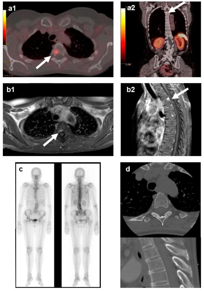 https://cdn.ncbi.nlm.nih.gov/pmc/blobs/a755/6770134/c8ae68bfefee/cancers-11-01332-g002.jpg